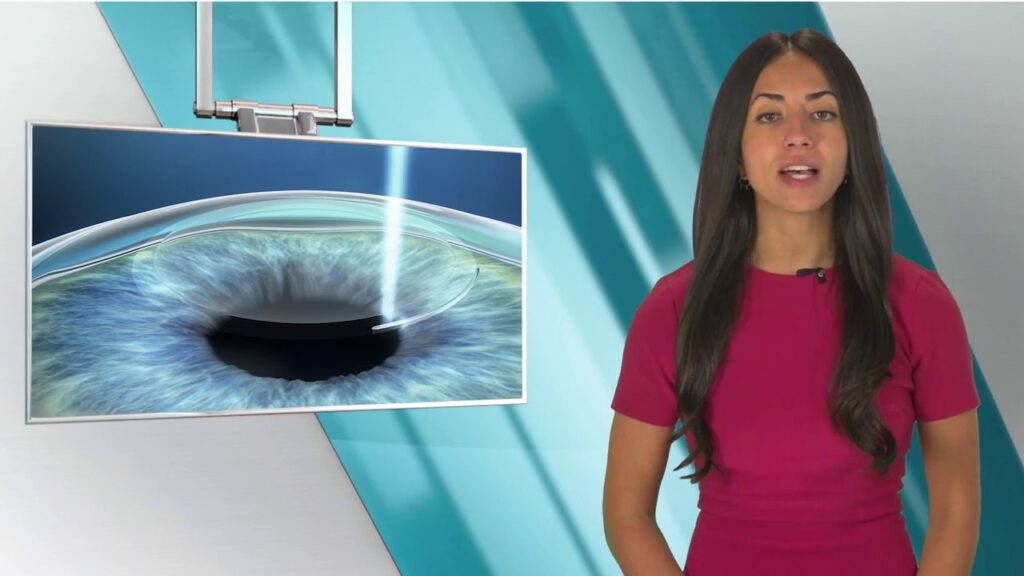Exceptional truths about cataract surgery
